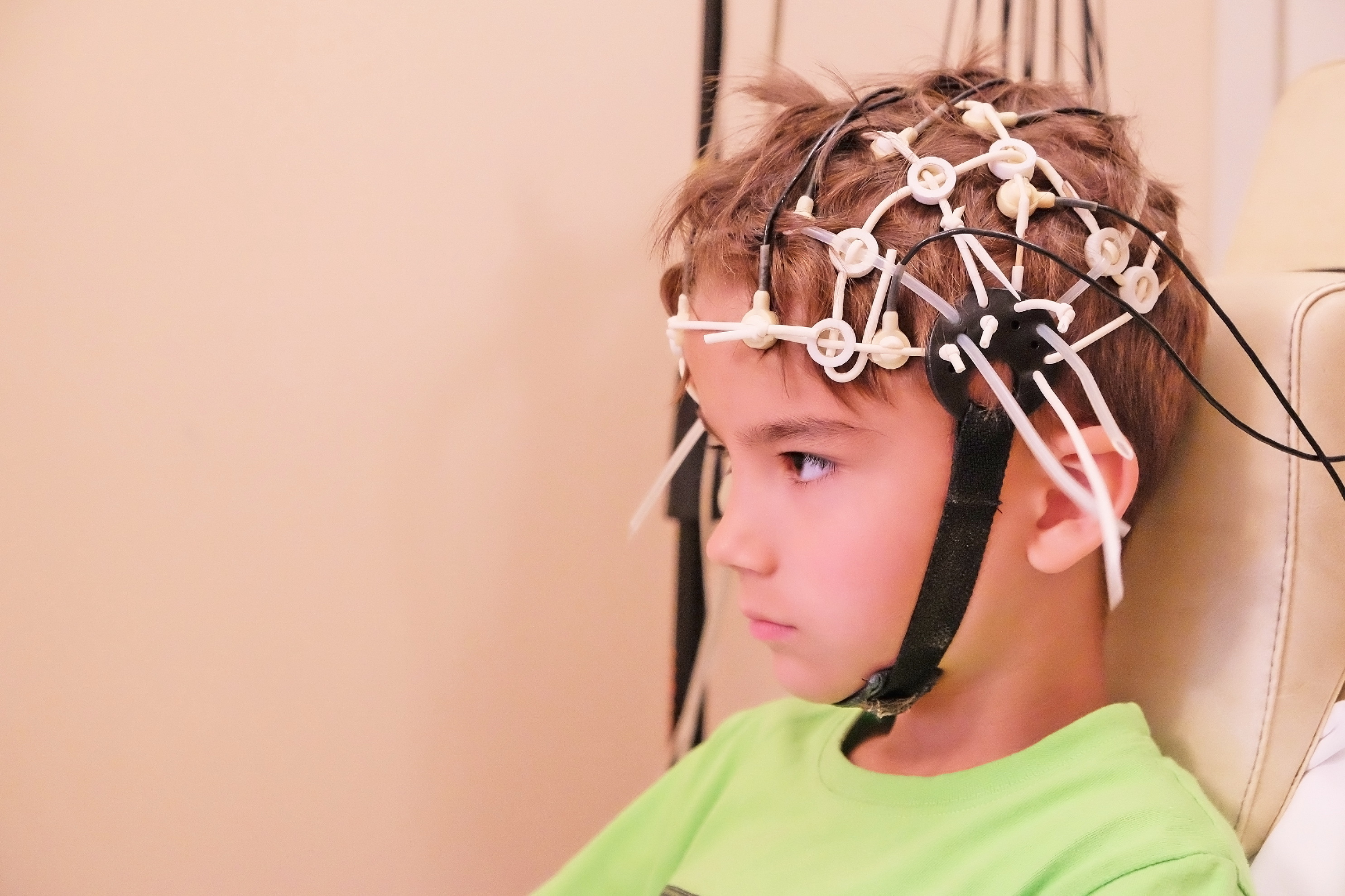 Die EEG-Untersuchung ist auch bei Kindern Teil der Epilepsie-Diagnose.